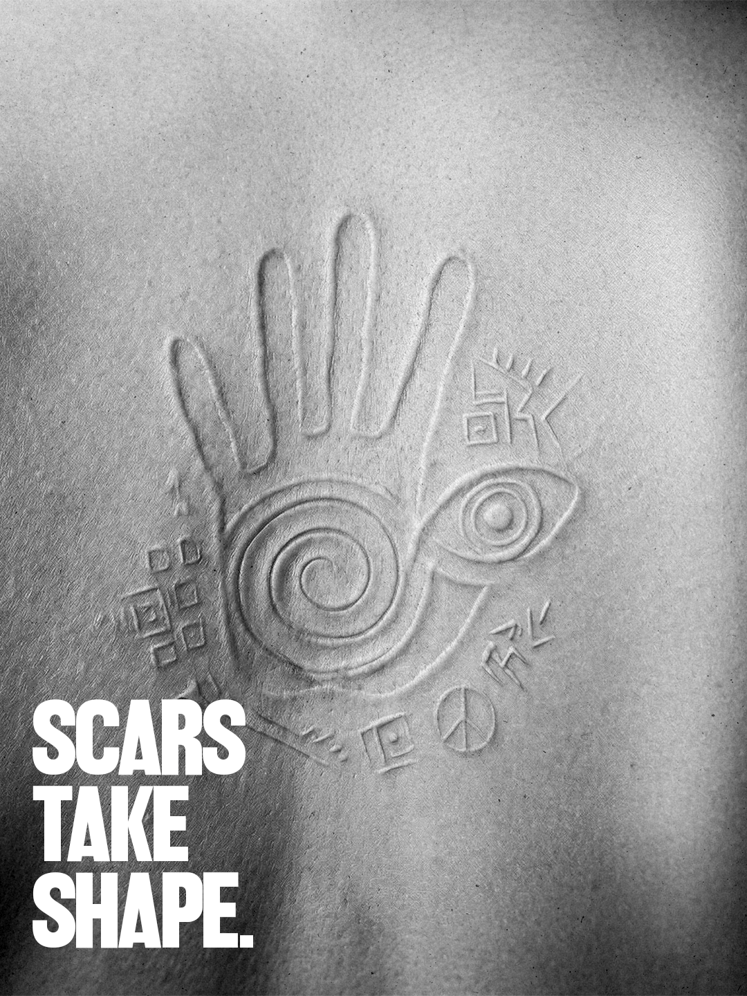 Scars take shape